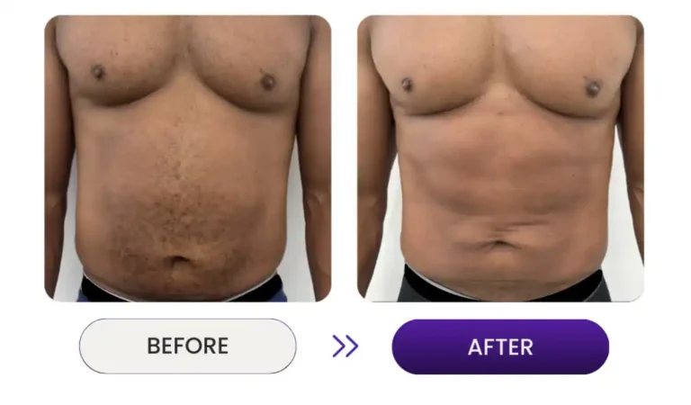 Man before and after stomach photos of athletic performance optimization